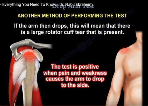 rotator cuff tests drop arm|drop arm test positive means.